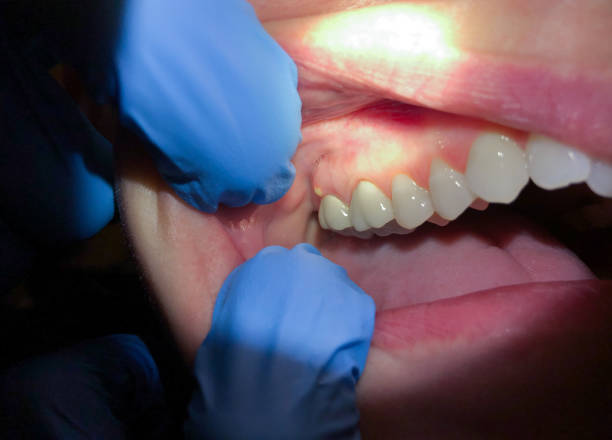 Best Emergency TMJ Treatment in Bolivar, TN
